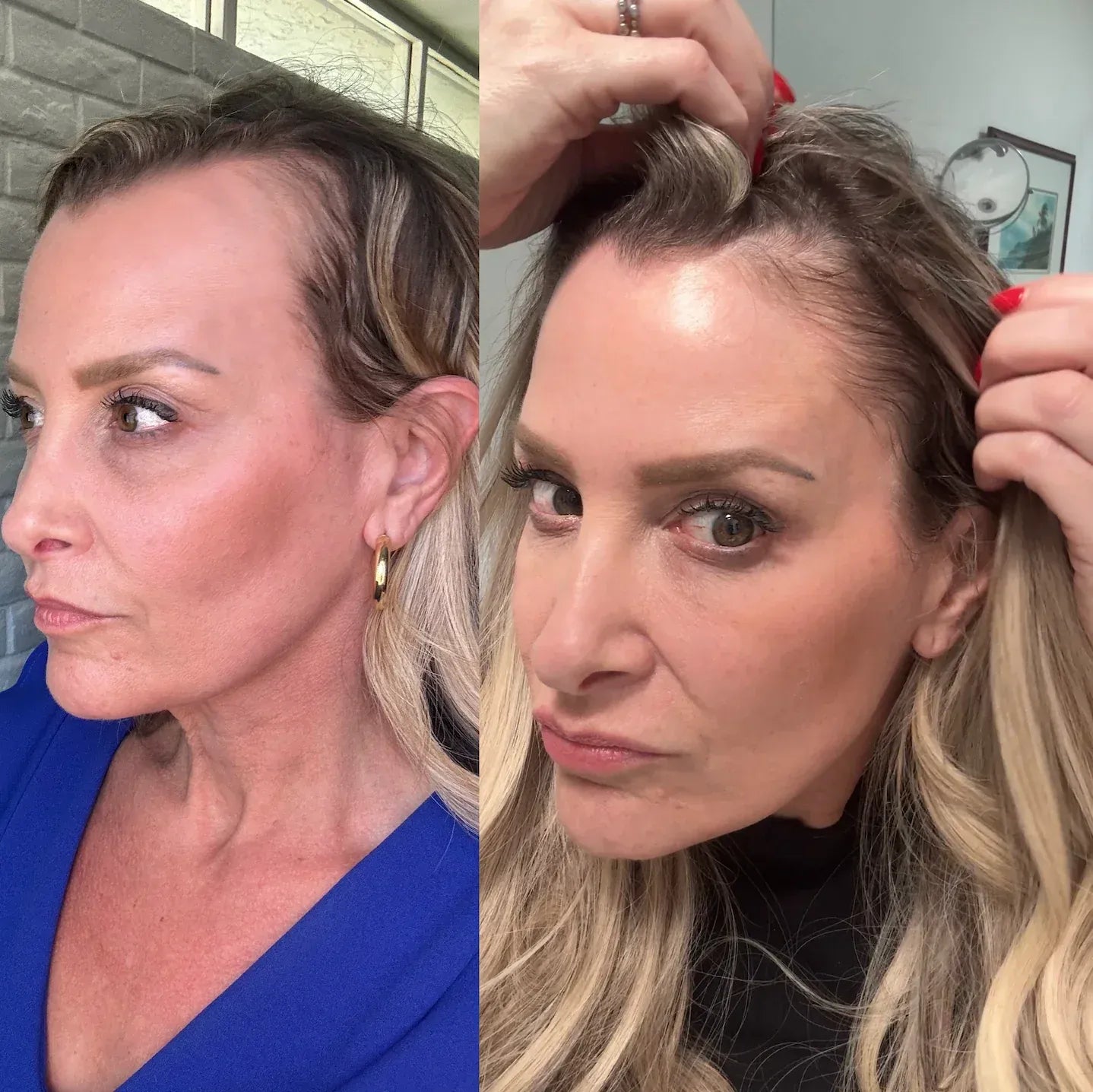 Stop The Hair Loss & Shedding With This